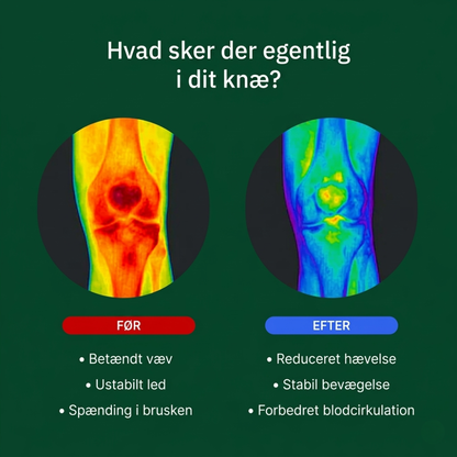 Nurovi - Knæstøtte